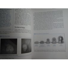 American Cancer Society Comp Guide to Colorectal Cancer