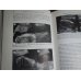 Obstetric Ultrasound: Volume 2 