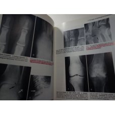 The Essentials of Skeletal Radiology 2 Vol Set, Yochum