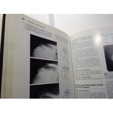 The Essentials of Skeletal Radiology 2 Vol Set, Yochum