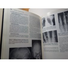 The Essentials of Skeletal Radiology 2 Vol Set, Yochum