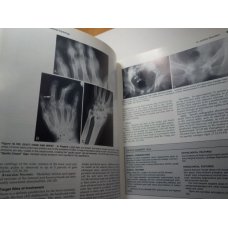 The Essentials of Skeletal Radiology 2 Vol Set, Yochum