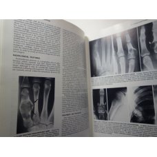 The Essentials of Skeletal Radiology 2 Vol Set, Yochum
