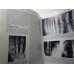 The Essentials of Skeletal Radiology 2 Vol Set, Yochum