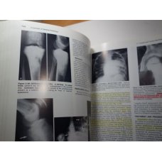 The Essentials of Skeletal Radiology 2 Vol Set, Yochum