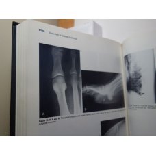 The Essentials of Skeletal Radiology 2 Vol Set, Yochum